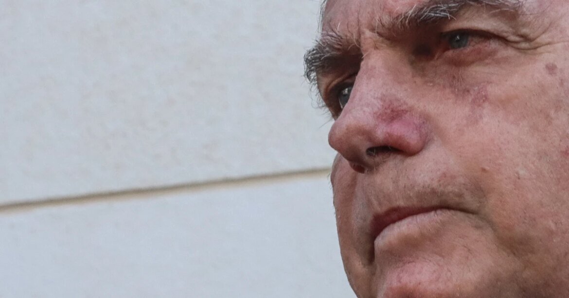 em-laudo-medico,-pf-diz-que-bolsonaro-recebe-tratamento-adequado-na-papudinha